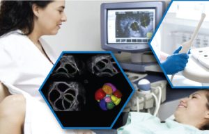 FollicularMonitoringUsingTransVaginalUltrasoundTraining