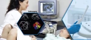 FollicularMonitoringUsingTransVaginalUltrasoundTraining