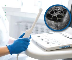 TransVaginal ScanTrainingForIVF