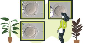 OocyteMorphologyAtlas