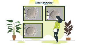 AtlasOocyteMorphology