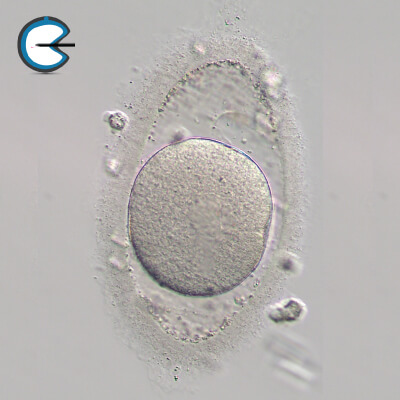 Oocyte with Uneven PVS