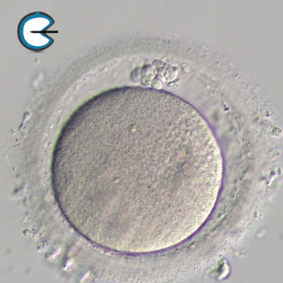 OocyteFragmentedPolarBodies