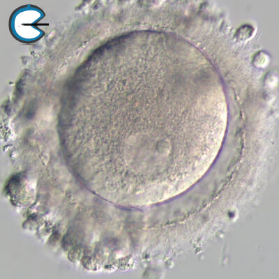 GerminalVesicleGVOocyte