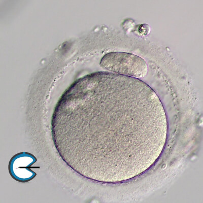 LargePolarBodyM2Oocyte