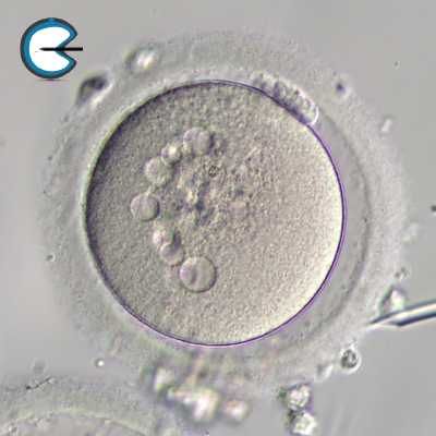 OocyteMultipleVacules