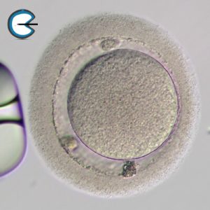 OocyteNecroticPolarBody