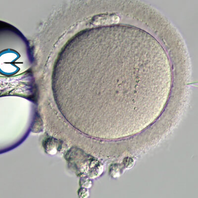 NormalOocyte