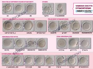 Oocyte Morphology Atlas